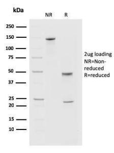 SDS-PAGE analysis of Anti-PD1 Antibody [PDCD1/2720] under non-reduced and reduced conditions; showing intact IgG and intact heavy and light chains, respectively. SDS-PAGE analysis confirms the integrity and purity of the antibody