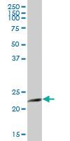 Anti-AK1 Mouse Polyclonal Antibody