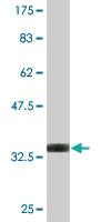 Anti-PIM1 Mouse Monoclonal Antibody [clone: 6F6]