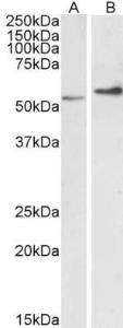 Anti-VIM Antibody (A85007) (0.1 µg/ml) staining of Mouse (A) and (2 µg/ml) Rat (B) Ovary lysate (35 µg protein in RIPA buffer). Primary incubation was 1 hour. Detected by chemiluminescence