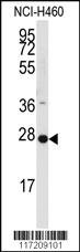 Anti-PPAP2C Rabbit Polyclonal Antibody