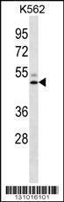 Anti-LIPC Rabbit Polyclonal Antibody (FITC (Fluorescein Isothiocyanate))