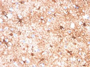 Immunohistochemical analysis of formalin-fixed, paraffin-embedded human cerebellum tissue using Anti-GFAP Antibody [GFAP/4450]