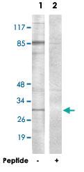 Anti-ATF5 Rabbit Polyclonal Antibody