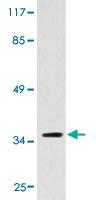 Anti-HTR5A Rabbit Polyclonal Antibody