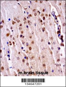 Anti-NEK3 Rabbit Polyclonal Antibody (Biotin)