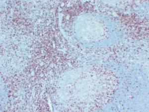 Immunohistochemical analysis of paraffin-embedded human Tonsil using Anti-CD5 Antibody