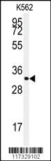 Anti-SRSF2 Rabbit Polyclonal Antibody