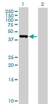 Anti-RP11-98F14.6 Mouse Polyclonal Antibody