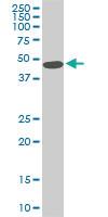 Anti-STK38 Mouse Monoclonal Antibody [clone: 6F1]