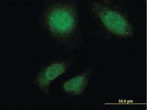 Anti-TTN Mouse Monoclonal Antibody [clone: 2B3]