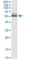 Anti-NPTX2 Polyclonal Antibody Pair