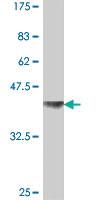 Anti-NUP214 Mouse Polyclonal Antibody