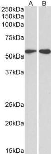 Anti-VIM Antibody (A85007) (2 µg/ml) staining of HeLa (A) and Jurkat (B) lysates (35 µg protein in RIPA buffer). Primary incubation was 1 hour. Detected by chemiluminescence