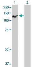 Anti-ATP2C1 Rabbit Polyclonal Antibody