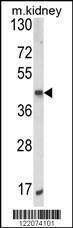 Anti-ALKBH3 Rabbit Polyclonal Antibody (Biotin)