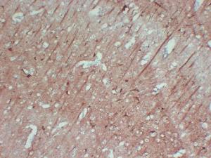 Immunohistochemical analysis of paraffin-embedded human Brain using Anti-Neurofilament Antibody