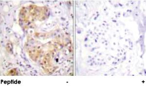 Anti-PRKCD Rabbit Polyclonal Antibody