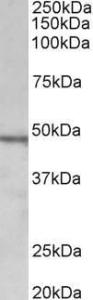 Anti-CHIT1 Antibody (A85008) (1 µg/ml) staining of Daudi lysate (35 µg protein in RIPA buffer) Primary incubation was 1 hour Detected by chemiluminescence