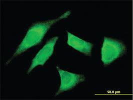 Anti-UTRN Mouse Monoclonal Antibody [clone: 5G6]