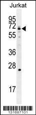 Anti-GCLC Rabbit Polyclonal Antibody (AP (Alkaline Phosphatase))