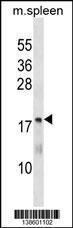 Anti-MTHFS Rabbit Polyclonal Antibody (HRP (Horseradish Peroxidase))