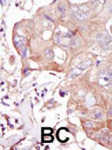 Anti-MAP4K3 Rabbit Polyclonal Antibody (Biotin)