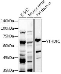 Anti-YTHDF1 Rabbit Polyclonal Antibody