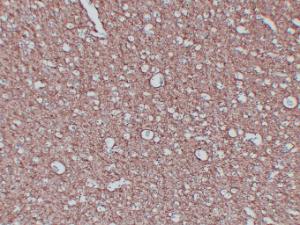 Anti-Myelin Basic Protein Mouse Monoclonal Antibody [clone: ABT-MBP]