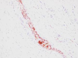 Immunohistochemical analysis of paraffin-embedded human Colon using Anti-Neurofilament Antibody