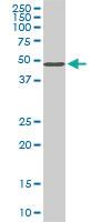 Anti-STK38 Mouse Monoclonal Antibody [clone: 6F1]