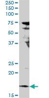 Anti-IL17F Rabbit Polyclonal Antibody