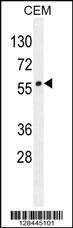 Anti-LIPC Rabbit Polyclonal Antibody (FITC (Fluorescein Isothiocyanate))