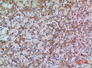 Immunohistochemical analysis of paraffin-embedded human liver using Anti-HSD17B4 Antibody