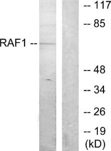 Western blot analysis of lysates from K562 cells using Anti-C-RAF Antibody The right hand lane represents a negative control, where the antibody is blocked by the immunising peptide