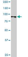 Anti-ATP2C1 Rabbit Polyclonal Antibody