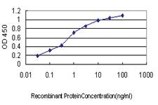 Anti-TTN Mouse Monoclonal Antibody [clone: 2B3]