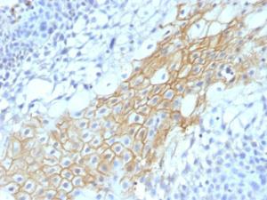 Immunohistochemical analysis of formalin-fixed, paraffin-embedded human tongue using Anti-CD59 Antibody [MACIF/1193]