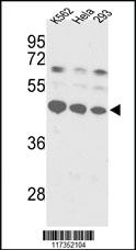 Anti-SSB Rabbit Polyclonal Antibody