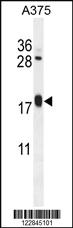 Anti-ARL8A Rabbit Polyclonal Antibody