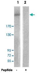 Anti-PIKFYVE Rabbit Polyclonal Antibody