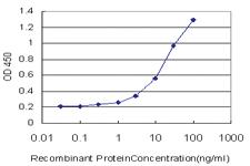 Anti-LRAT Mouse Monoclonal Antibody [clone: 1A11]