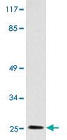 Anti-IGLL1 Rabbit Polyclonal Antibody