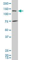 Anti-JMY Mouse Polyclonal Antibody