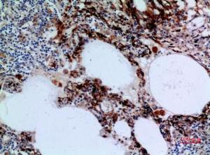 Immunohistochemical analysis of paraffin-embedded human lung using Anti-HSD17B4 Antibody