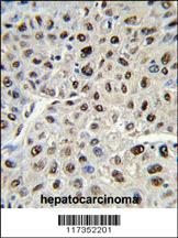 Anti-SSB Rabbit Polyclonal Antibody