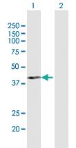 Anti-PCID2 Rabbit Polyclonal Antibody