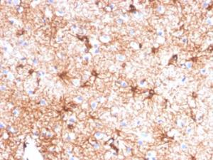 Immunohistochemical analysis of formalin-fixed, paraffin-embedded human cerebellum tissue using Anti-GFAP Antibody [GFAP/4450]