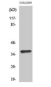 Western blot analysis of various cells using Anti-OR4A15 Antibody