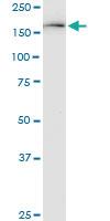 Anti-KDM6A Mouse Monoclonal Antibody [clone: 4E7]